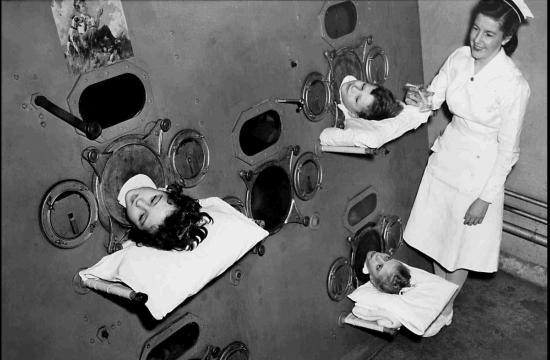 Children in Iron Lung. Courtesy of Boston Children's Hospital